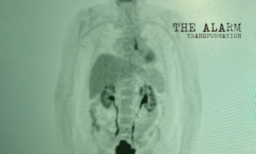 Album Review: The Alarm - Transformation