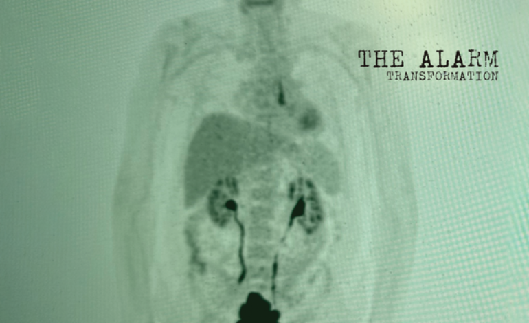 Album Review: The Alarm – Transformation